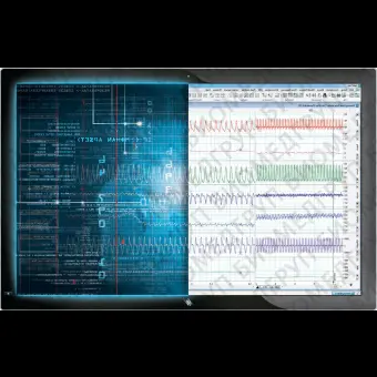 Программное обеспечение для электрофизиологических исследований Labchart