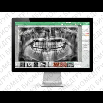 Программное обеспечение для обработки снимков зубов EzDenti