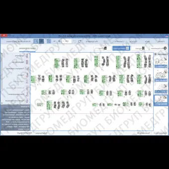 ПО для автоматического анализа хромосом, кариотипирования, АргусKaryo, АргусСофт, ARGUS  KARYO
