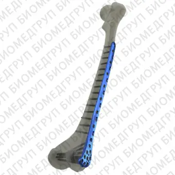 Компрессионная костная пластина бедренная кость Femur