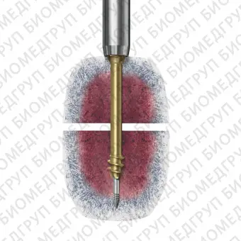 Общий компрессирующий винт для кости HCS 4.5, 6.5
