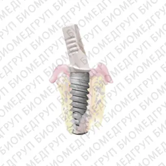 Цилиндрический конический зубной имплантат Shark Dental Implant