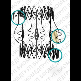 Аортальный биопротез клапана сердца Perceval