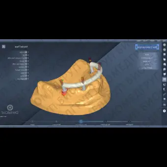 Программное обеспечение для лабораторий DentalCad