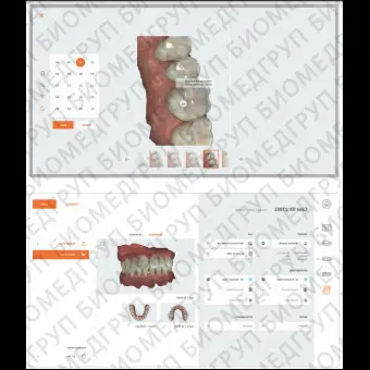 Программное обеспечение для обработки снимков зубов HeronClinic 3.1