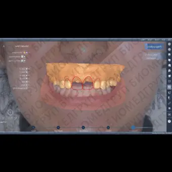 Программное обеспечение для лабораторий DentalCad