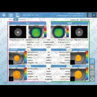 Роговичный топограф OPDScan III VS