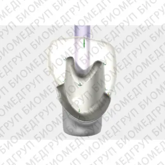 Exocad Implant Module  модуль для создания имплантов