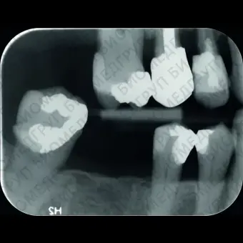 Сканер Scan eXam One