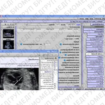 Медицинское программное обеспечение Gynaecology