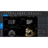 Программное обеспечение для обработки снимков зубов SmartV Pro